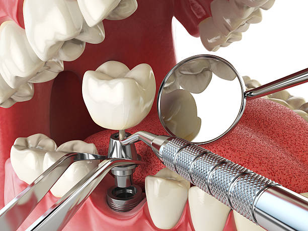 Dentist for Dental Trauma in IA